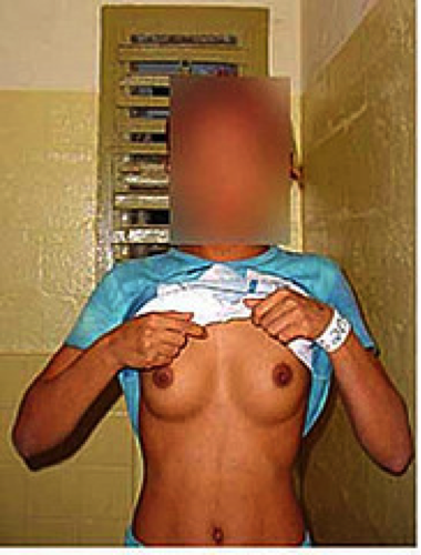 A female prisoner in Abu Ghraib showing her breasts in a photograph taken by Cpl. Charles Graner, on October 29, 2003. During the Iraq War, United States Army military personnel physically and sexually abused, tortured, raped, sodomized, and killed prisoners held in the Abu Ghraib prison. 